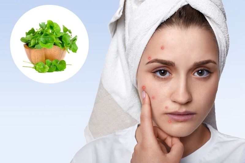 Rau má với công dụng trị mụn